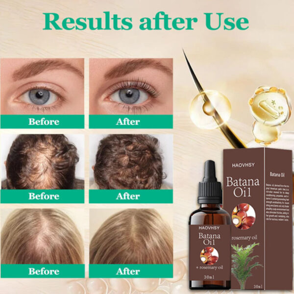Batana Hair Care Essential Oil - Image 3